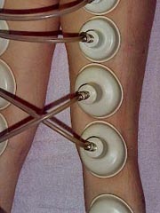 Legs Legs