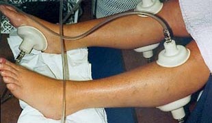 Spine treatment Spine treatment