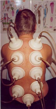 Back treatment Back treatment