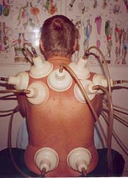 Back treatment Back treatment