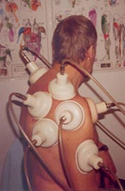 Back treatment Back treatment